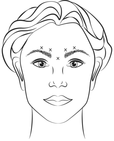 Figura 1: