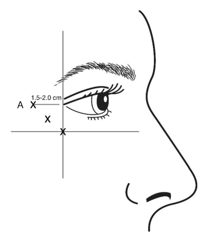 Figura 2: Figura 3: