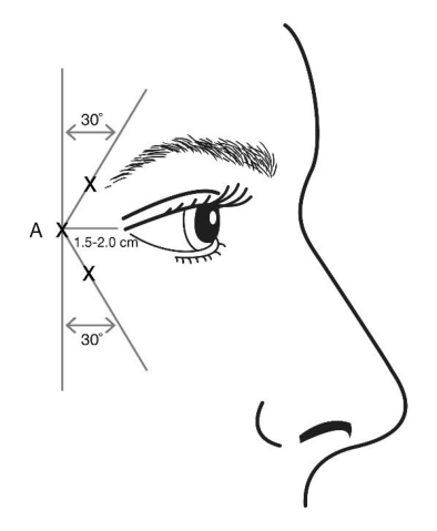 Figura 2: Figura 3: