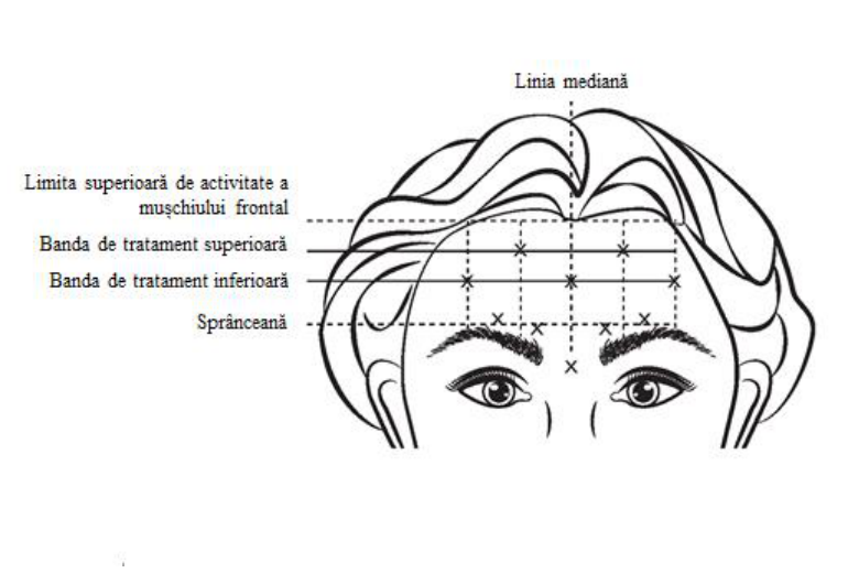 Figura 4: